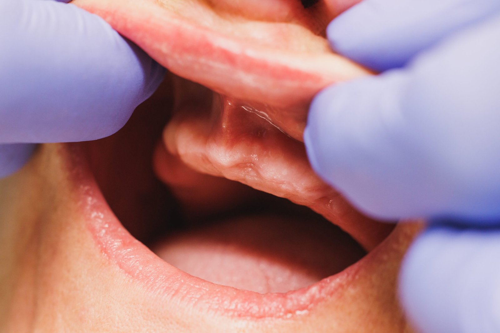 close up of a dental proces of implantation of tee 2023 11 27 05 04 02 utc scaled