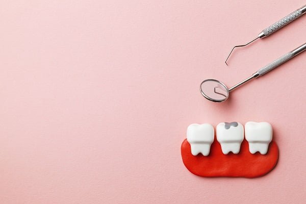 dental filling 2304