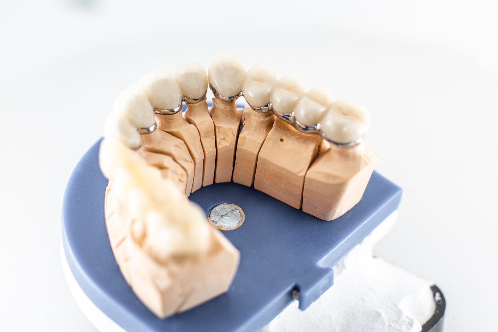 dental imprint with artificial teeth 2023 11 27 05 07 29 utc scaled