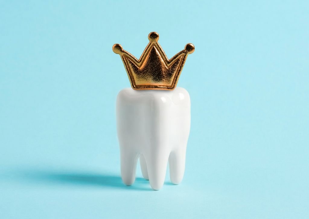 Dental Crown & Bridge in Alam Impian, Shah Alam