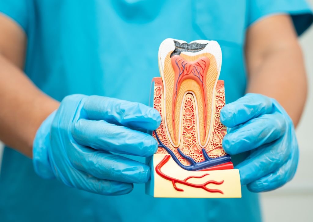 Dental Crown & Bridge in Alam Impian, Shah Alam